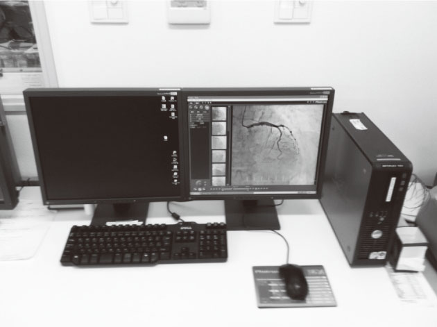 図3　血管造影の操作室