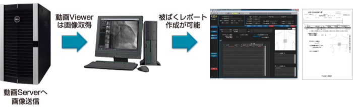 動画Serverへ画像送信＞動画Viewerは画像取得＞被ばくレポート作成が可能